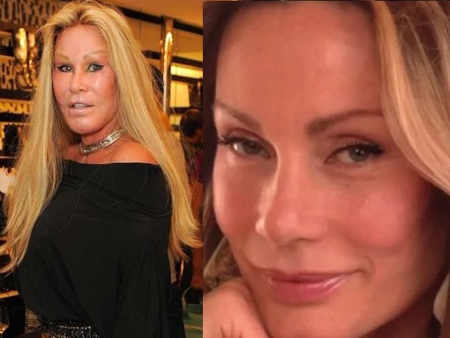 Jocelyn Wildenstein