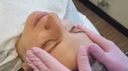 Anti-aging facial treatments